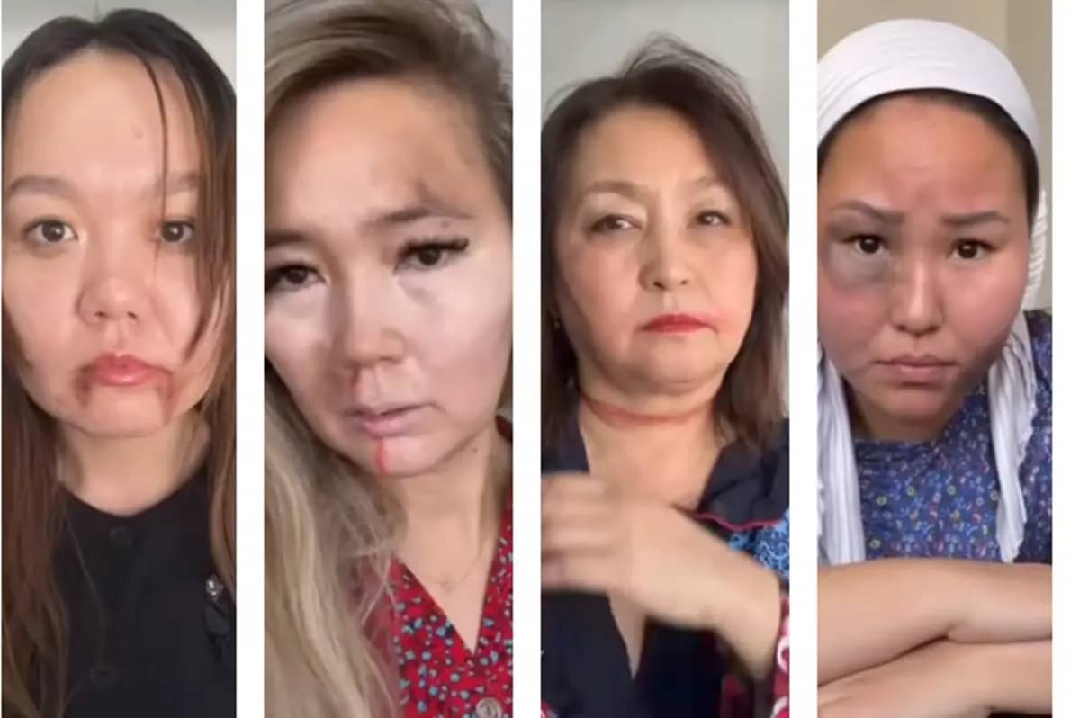 Учителя с «побоями» на лицах: школа №23 в Актау привлекает внимание к насилию