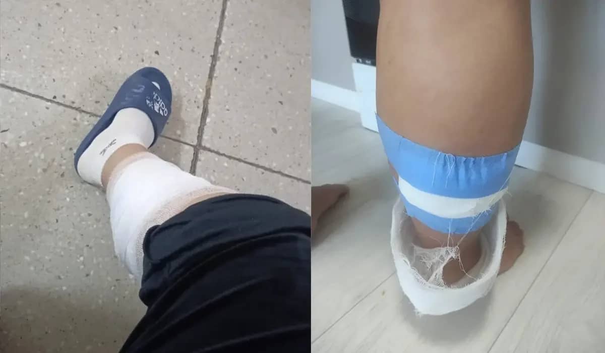 Көкшетауда жүкті әйелді бір топ құтырған ит қауып алған