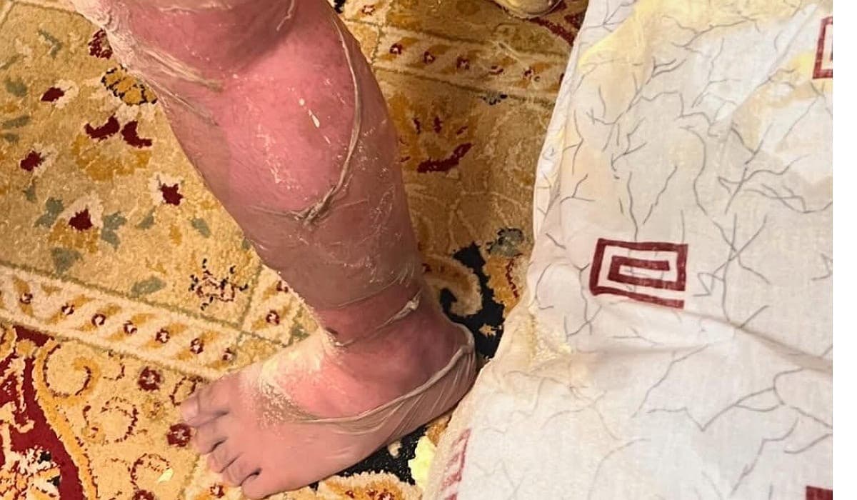 Ақтаудағы апат: 11 жастағы бала көшеде ашық құдыққа құлап, күйіп қалды