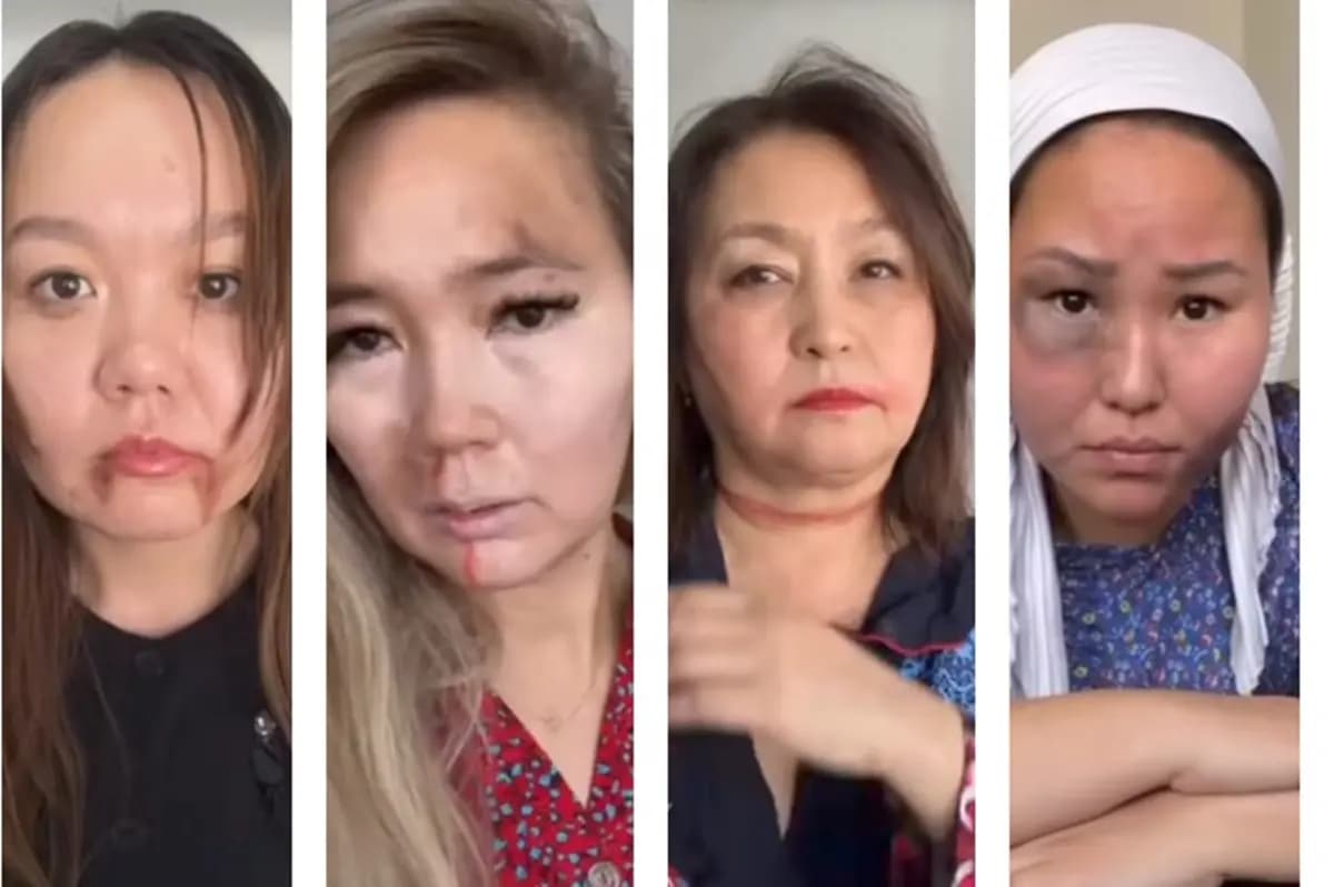 Учителя с «побоями» на лицах: школа №23 в Актау привлекает внимание к насилию