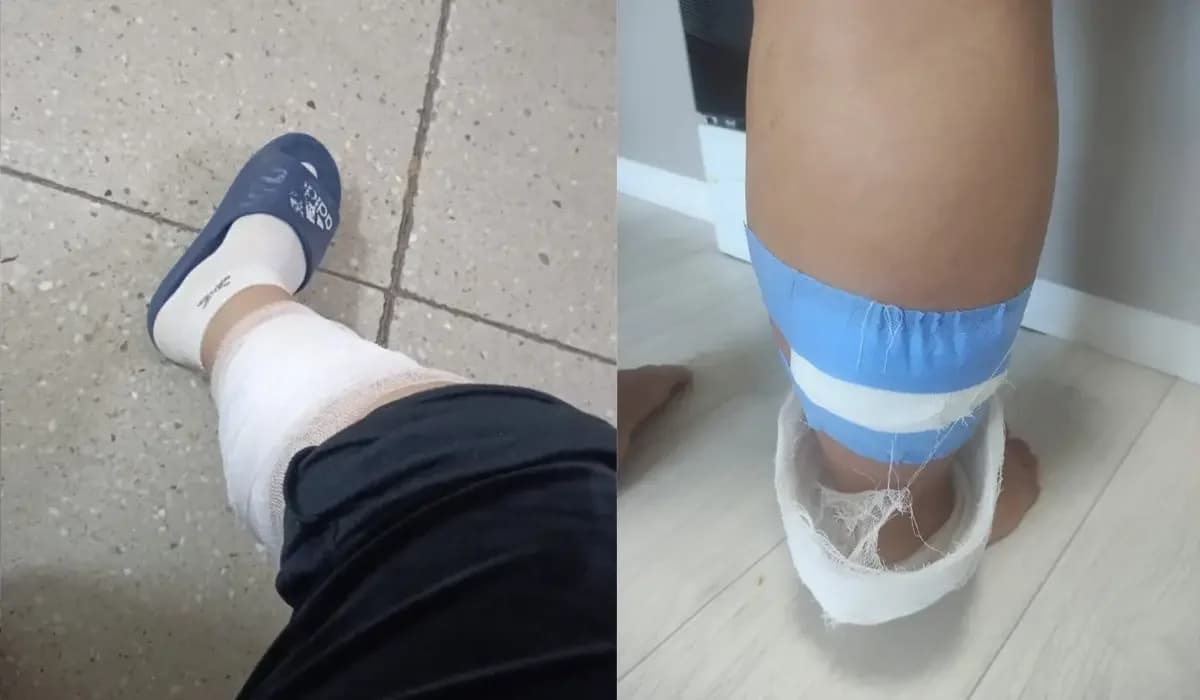 Көкшетауда жүкті әйелді бір топ құтырған ит қауып алған