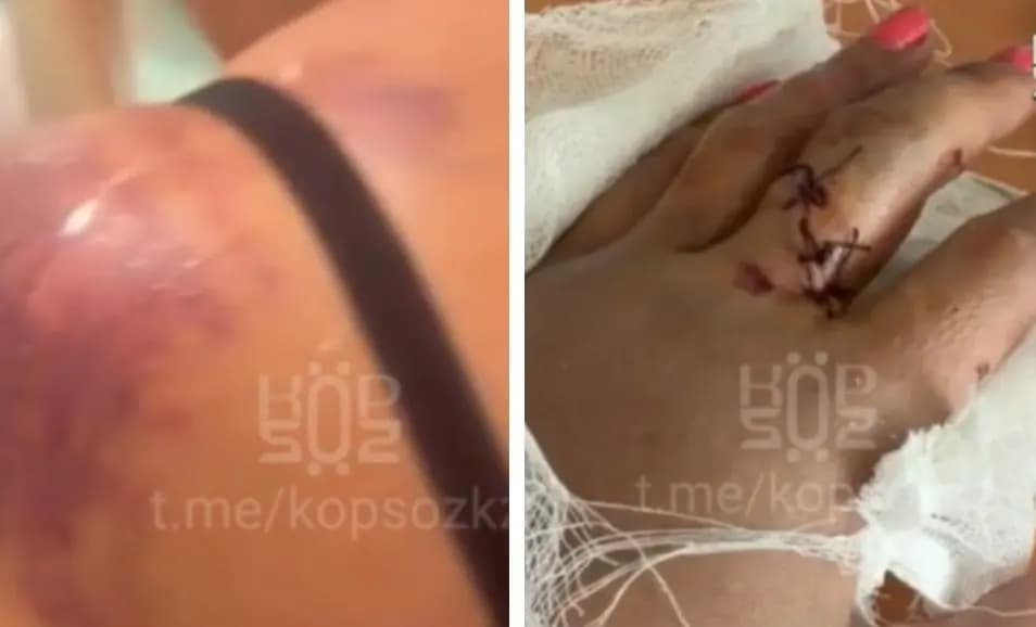 В Жетысу жительницу села Суыксай жестоко избили лопатой - возбуждено дело