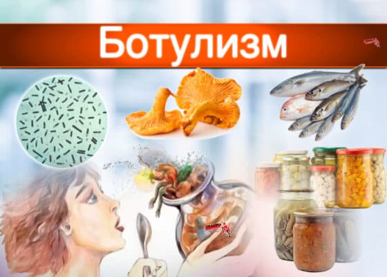 Ботулизмнің алдын алу