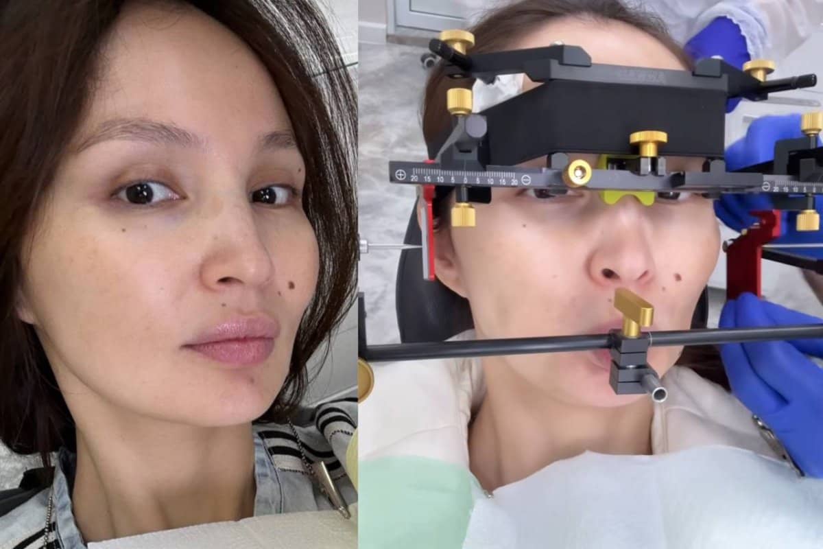 Жұлдыз Әбдікәрімова: Жақ сүйегімен күресіп жүргеніме екі жыл болды