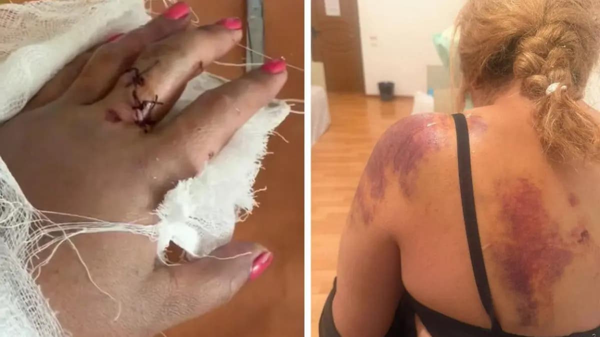 Жетісуда ер адам баласына араша түскен әйелді 40 рет күрекпен ұрып тастаған