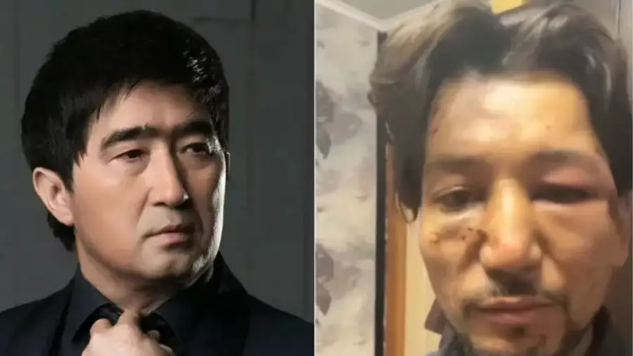 Үш жылға сотталады: әнін айтқан әншінің мұрнын бұзып, қолын сындырған Мұқасан ақыры ұсталды