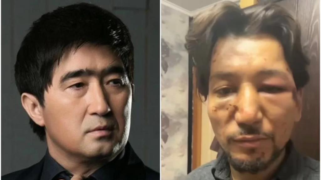 «Жабылып қолы мен мұрнын сындырған»: Мұқасан Шахзадаев жас әншіні ұрып-соққан